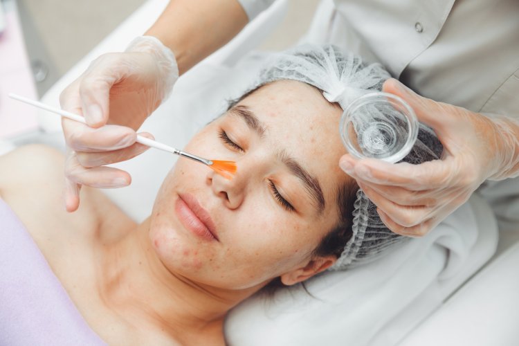 Enzyme Peels vs. Chemical Peels: The Benefits Explained